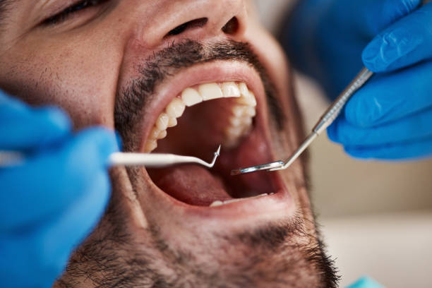Best Orthodontic Emergency Dentist in Oakland, OR